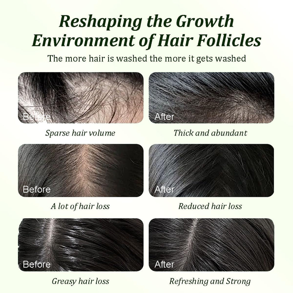 Gypsophila Batana Oil Shampoo scalp nourishment close-up highlights refreshed roots