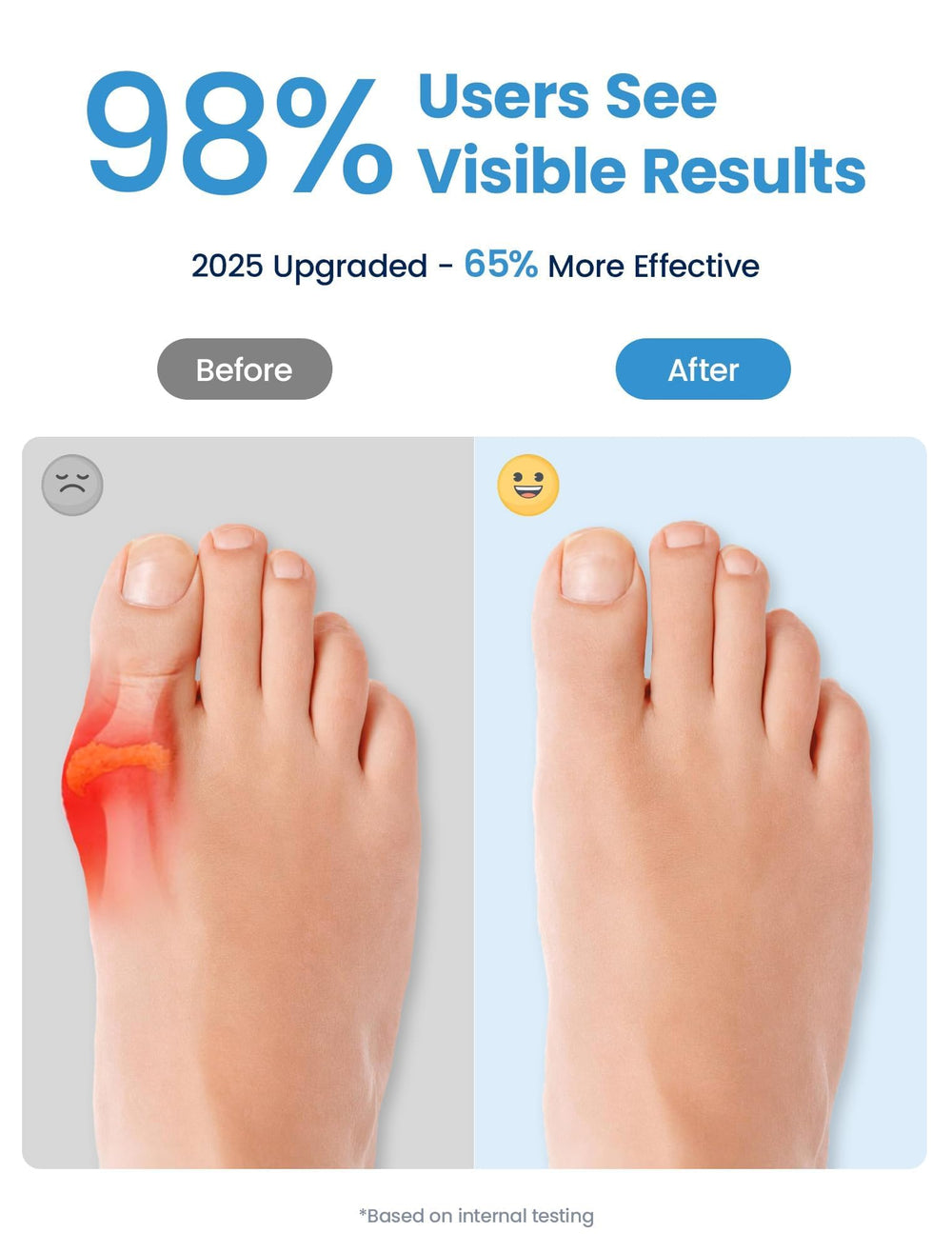Habioer toe separators soft nylon SEBS protect skin while spacing toes.
