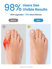 Habioer toe separators soft nylon SEBS protect skin while spacing toes.