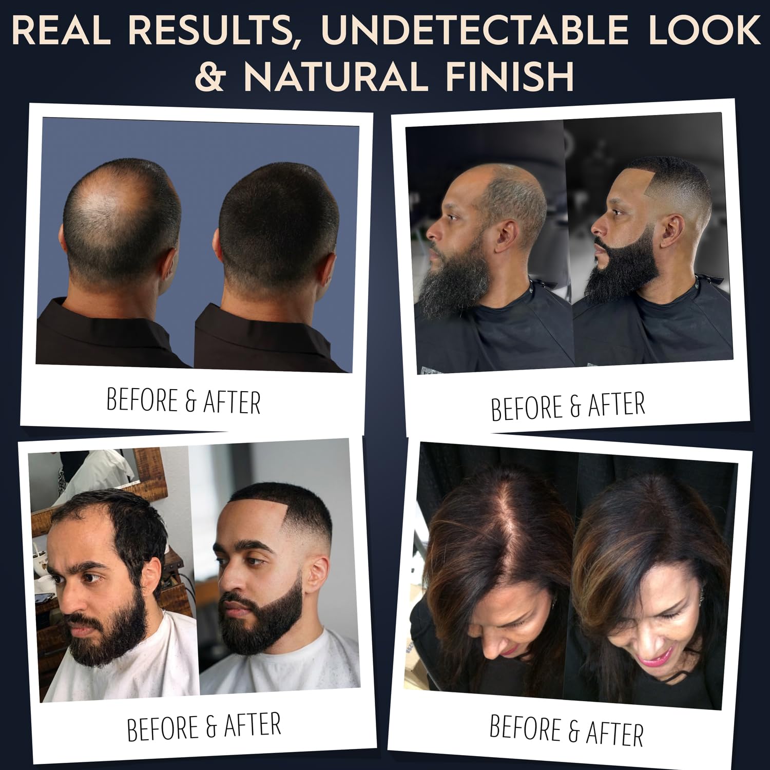 Hair Illusion detailed dispersion shows even coverage on scalp.