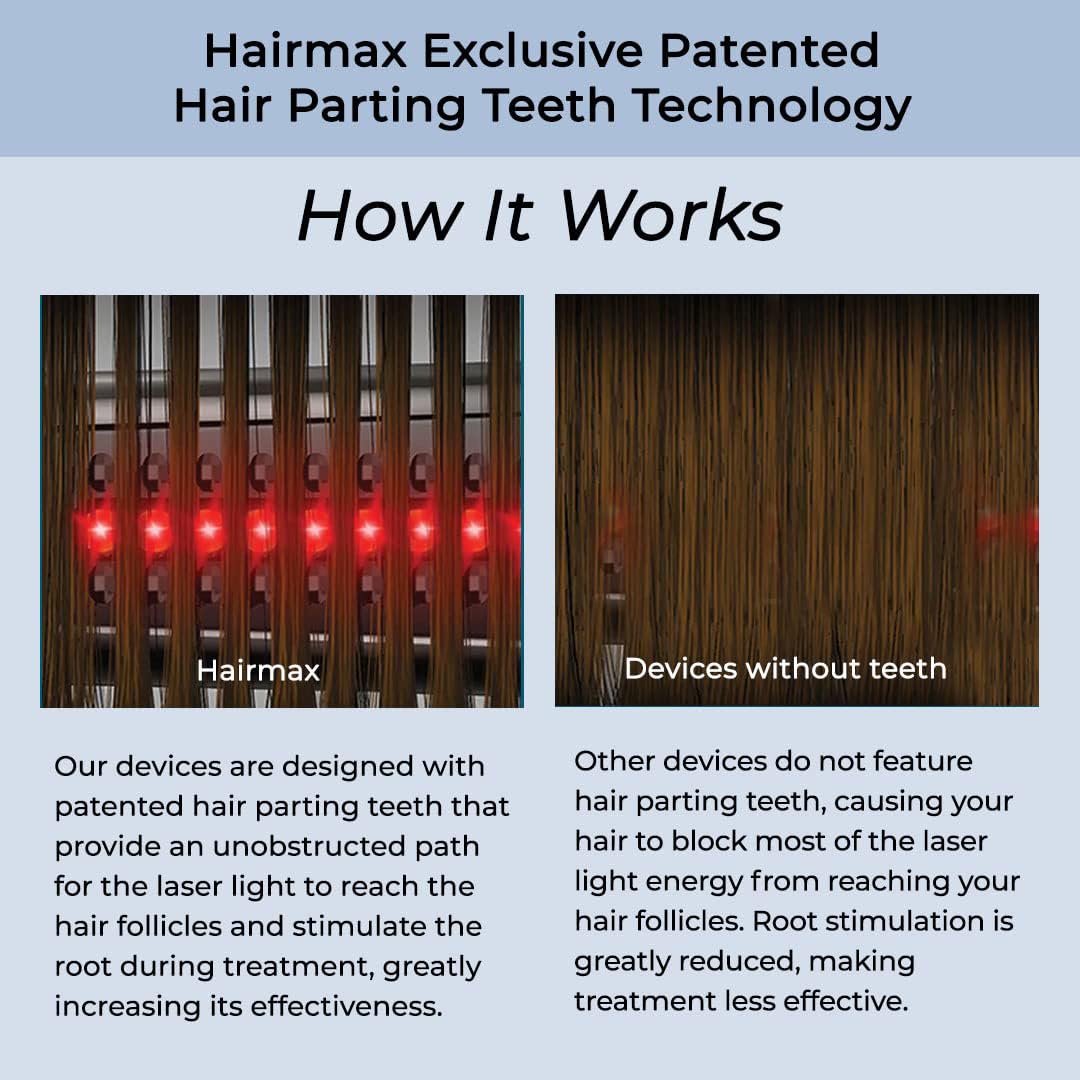 Hairmax Ultima 9 Classic with clinical trials badge on the box.