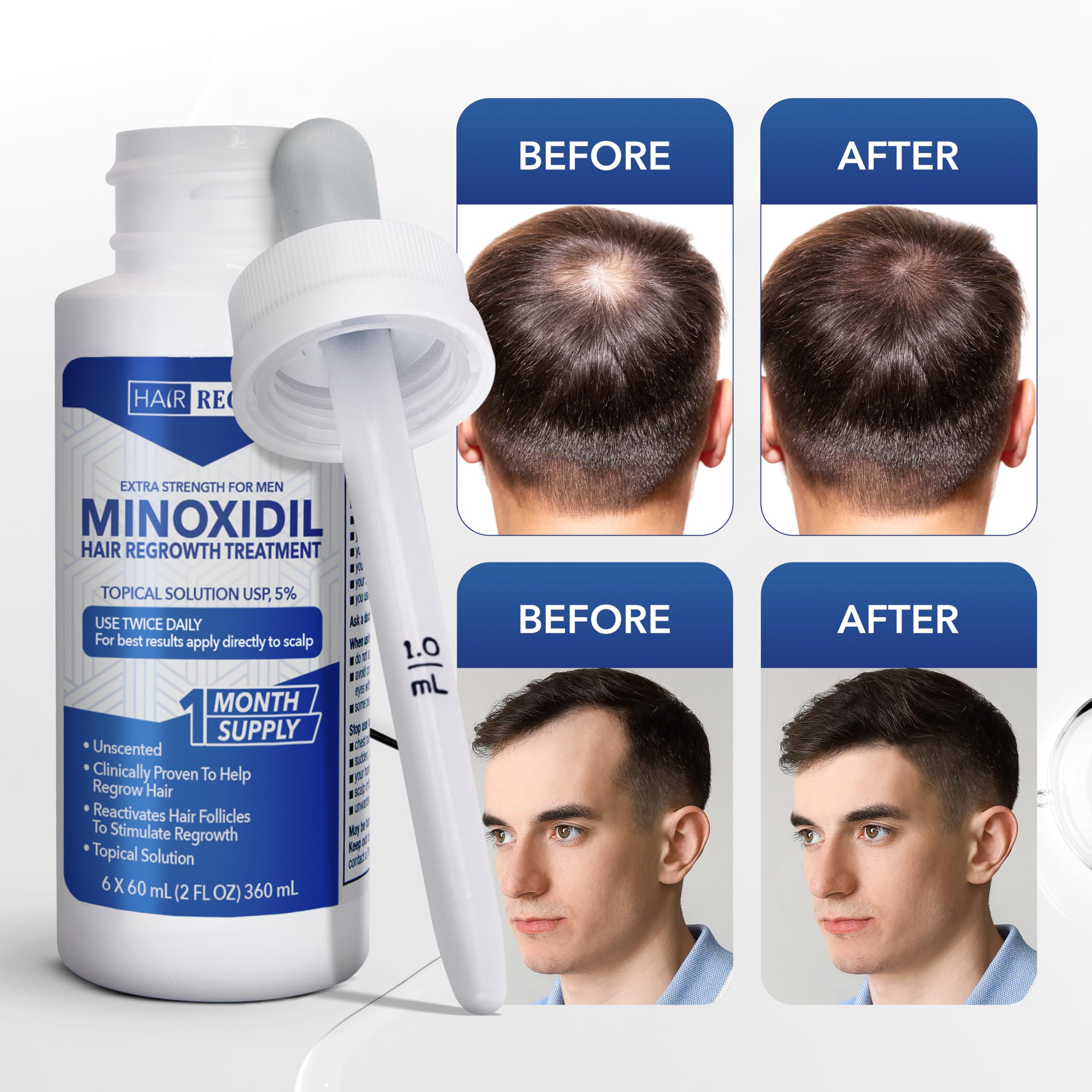Hair Regen minoxidil five percent dropper tip for targeted scalp application.