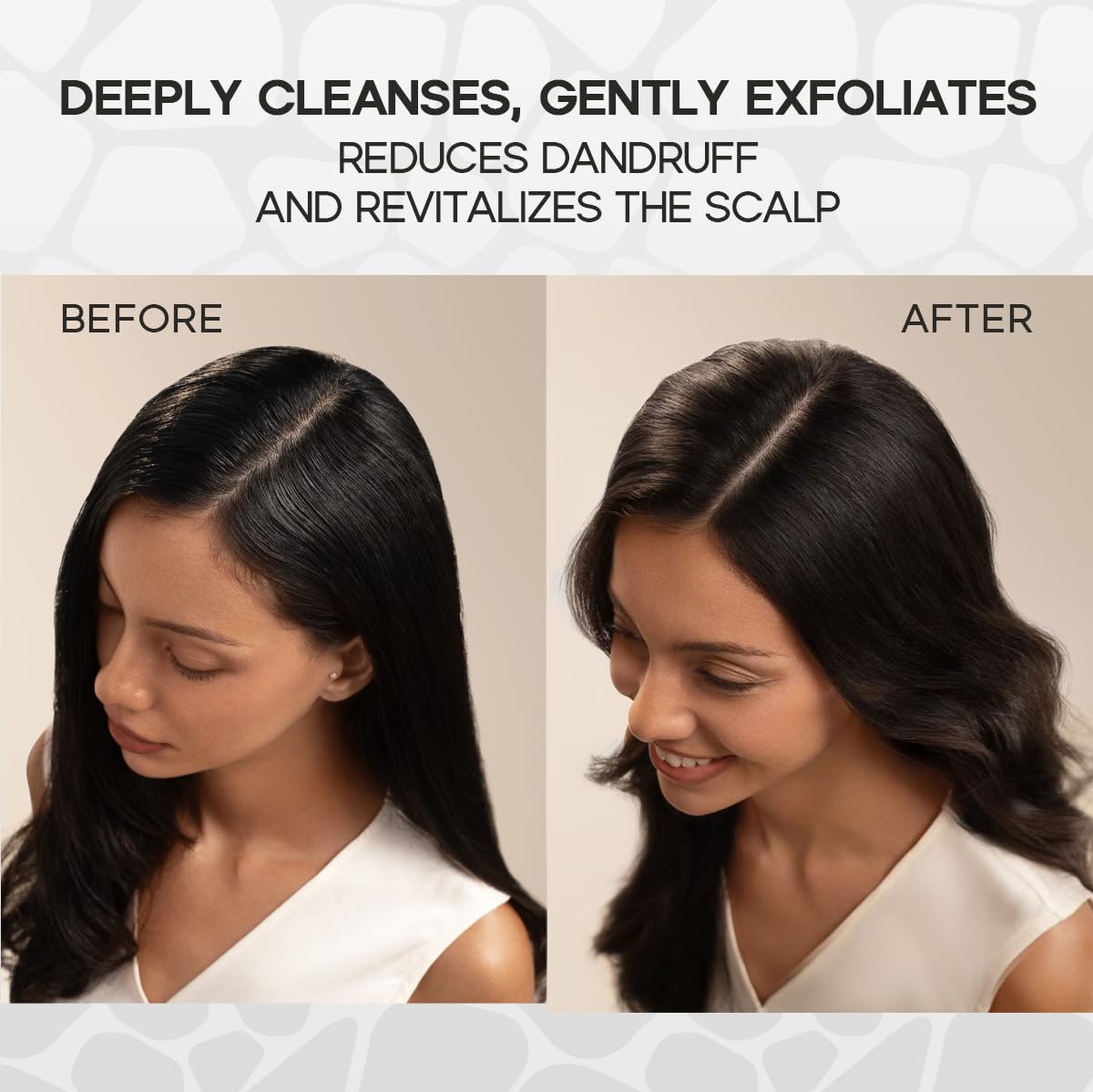 HALOVIDA scalp exfoliation close-up highlighting fine particles