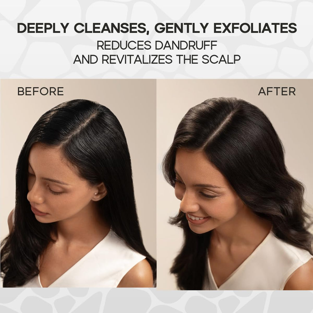 HALOVIDA scalp exfoliation close-up highlighting fine particles