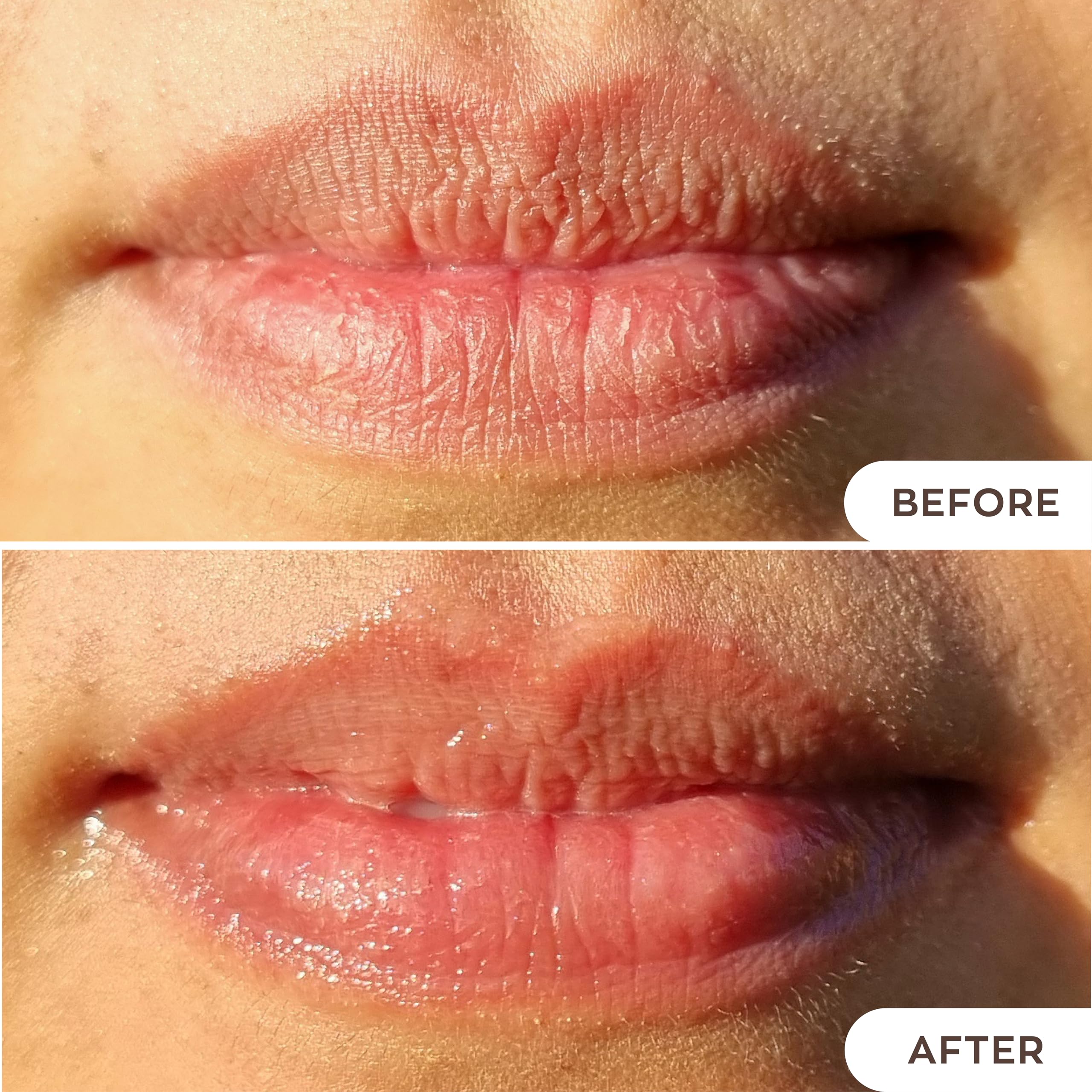 Hanalei Lip Treatment envase-15g: cuidado diario práctico.