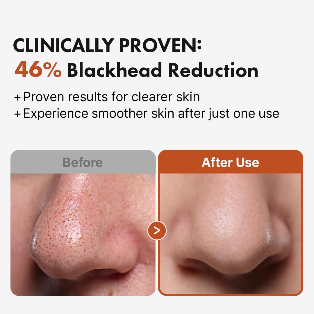 Hanskin BHA Pore Cleansing Oil removing makeup and impurities with gentle cleansing action.