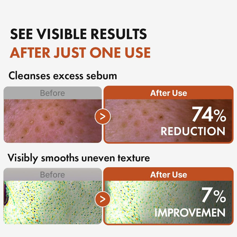 Hanskin BHA Pore Cleansing Oil dissolves waterproof makeup without irritating eyes.