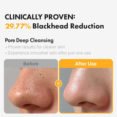Hanskin PHA Pore Cleansing Oil being rinsed for residue-free finish
