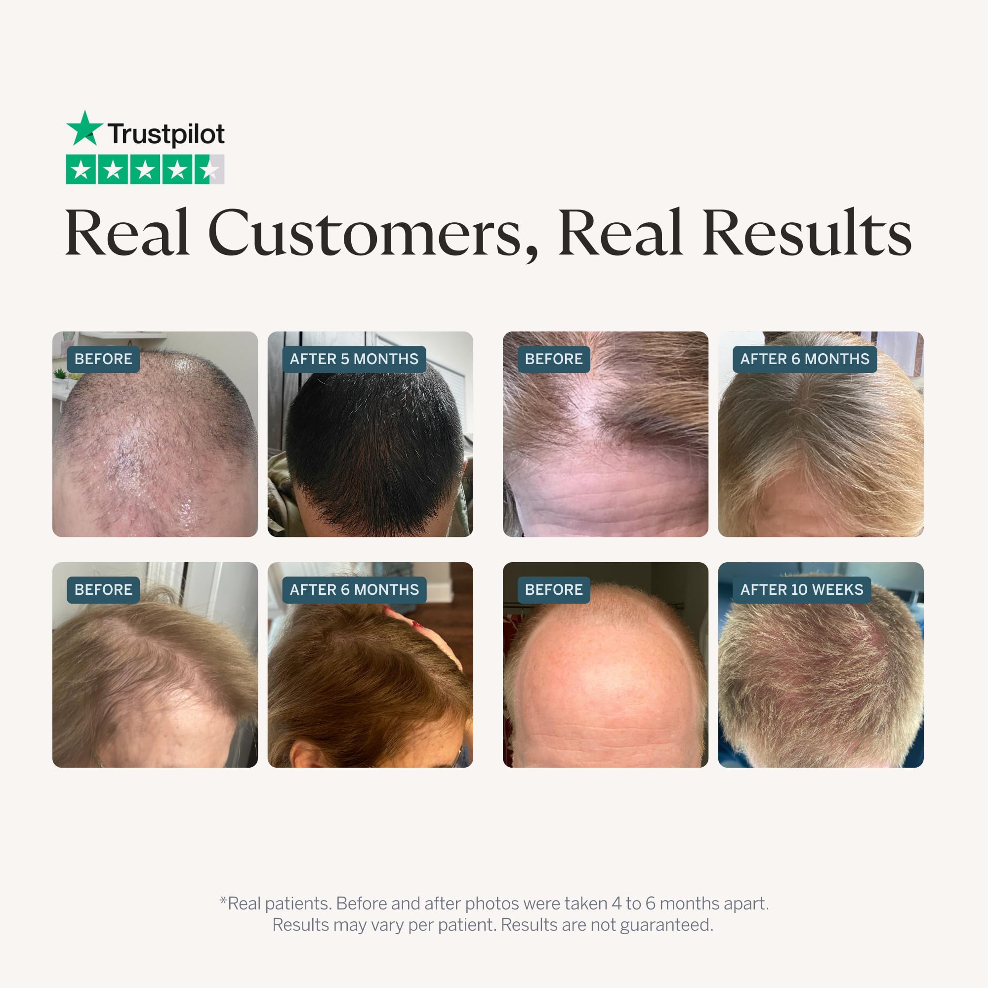 Happy Head capsules close-up for daily hair nourishment.