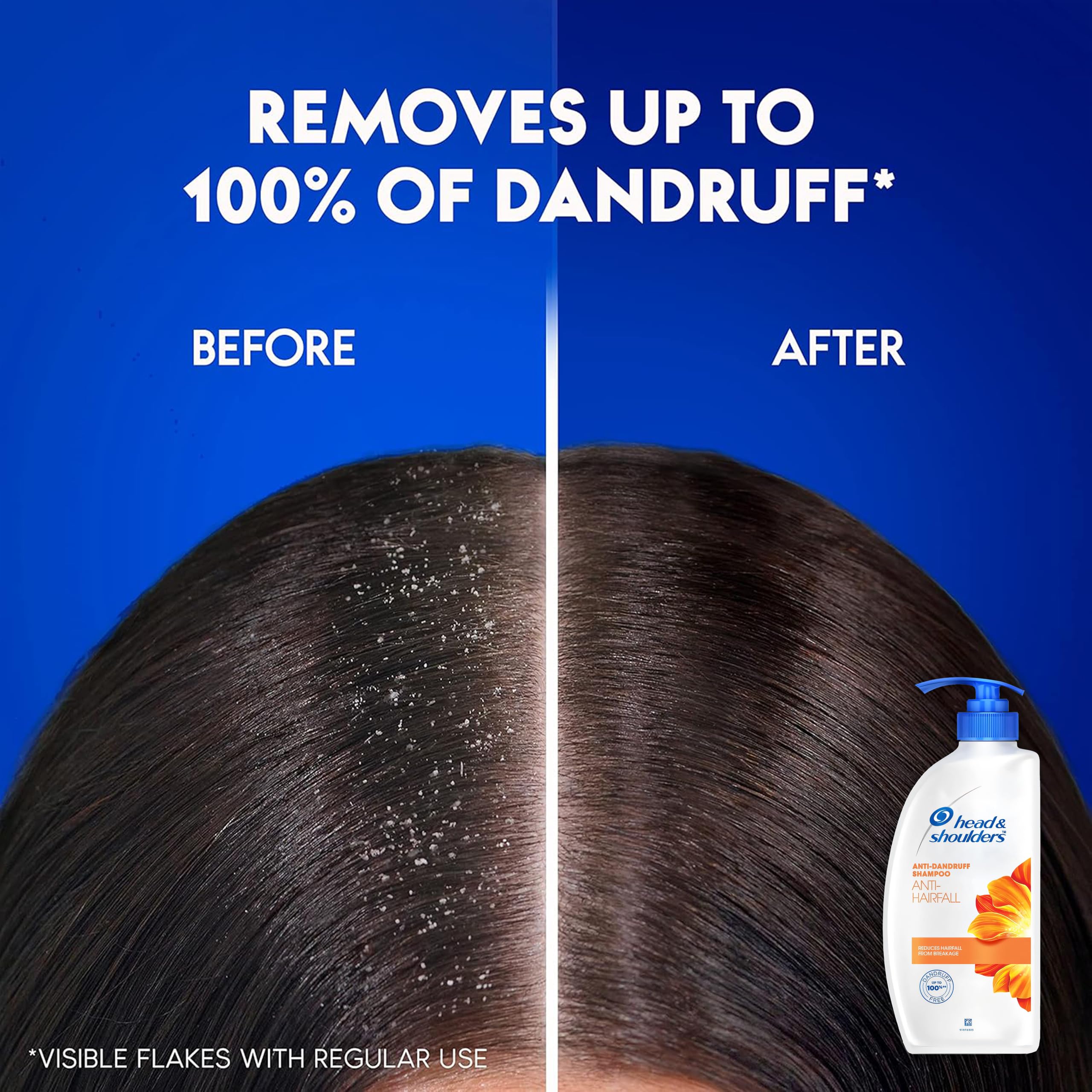Head & Shoulders, estante del baño con producto confiable para cabello