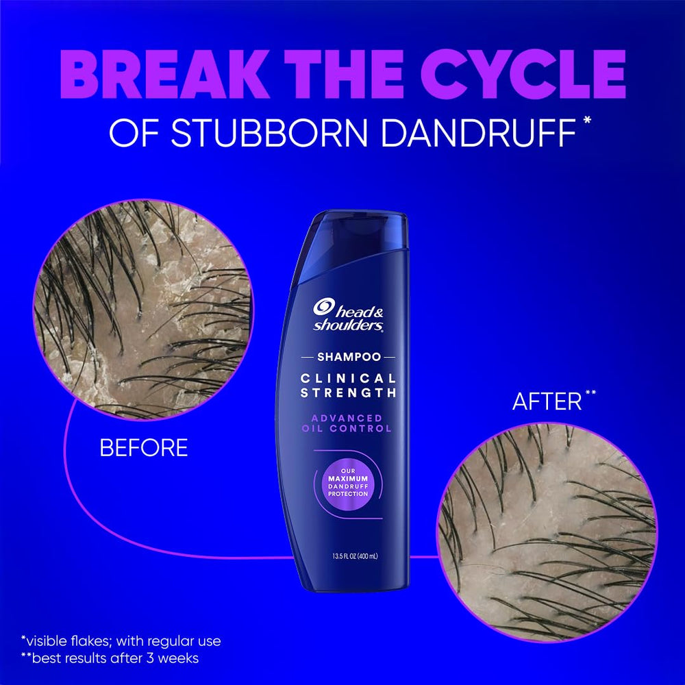 Head & Shoulders brillo saludable en cabello gracias a la fórmula