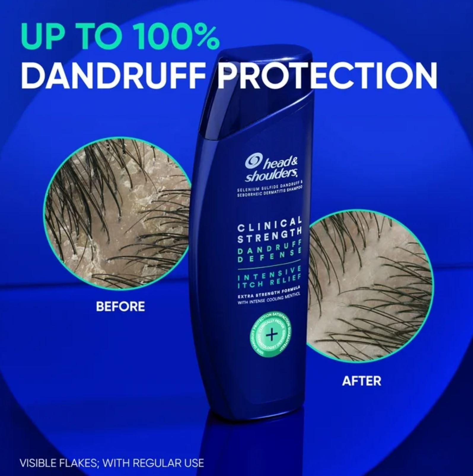 Head & Shoulders, uso diario en ducha para cabello limpio y manejable.