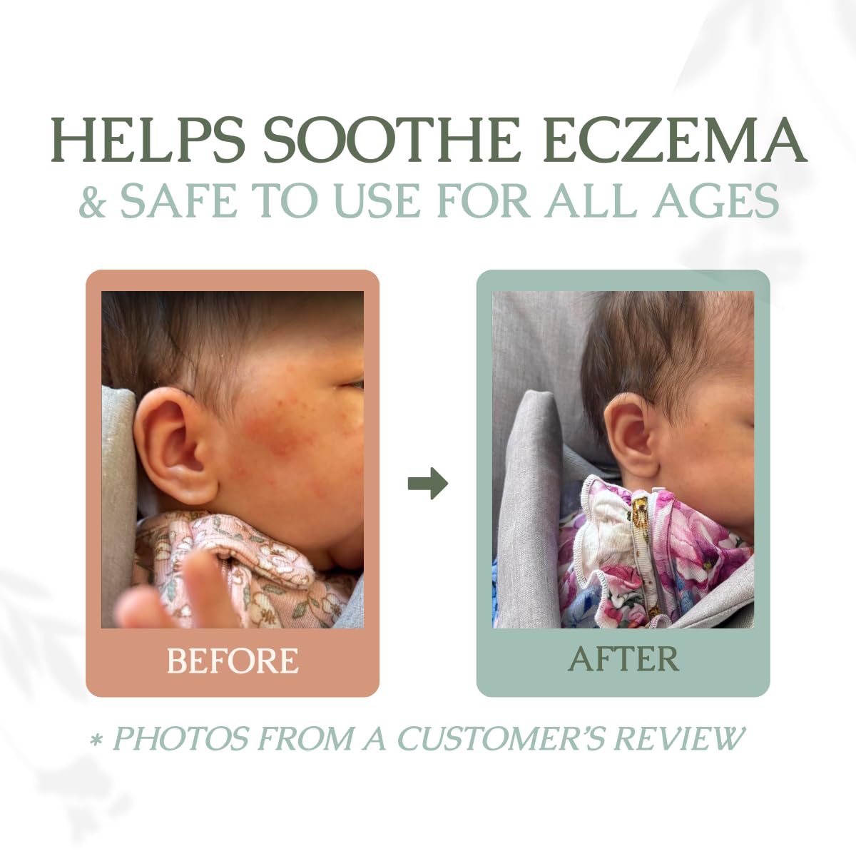 Hearth and Homestead baby-friendly balm — safe, mild skincare for little ones.