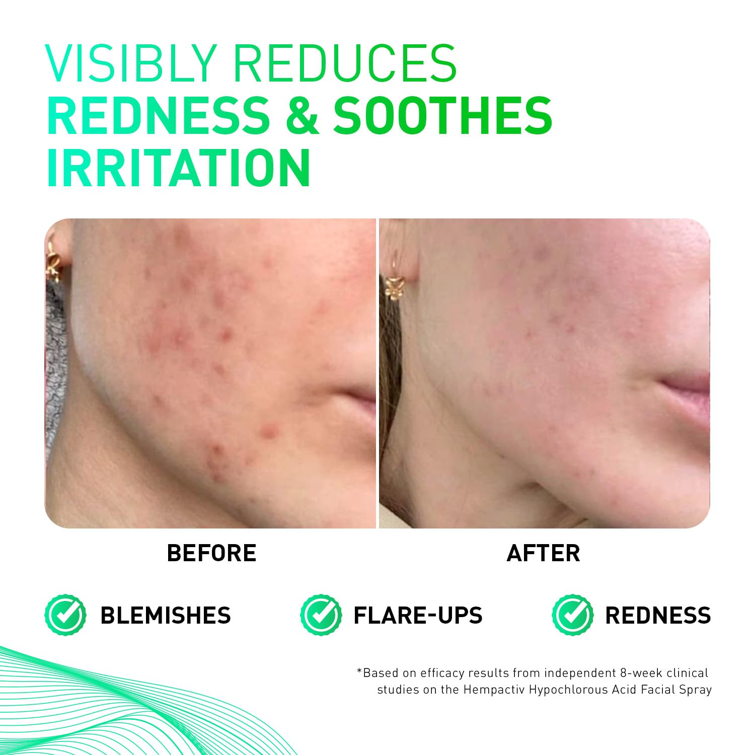 HEMPACTIV post-workout mist in action cooling and soothing the skin.