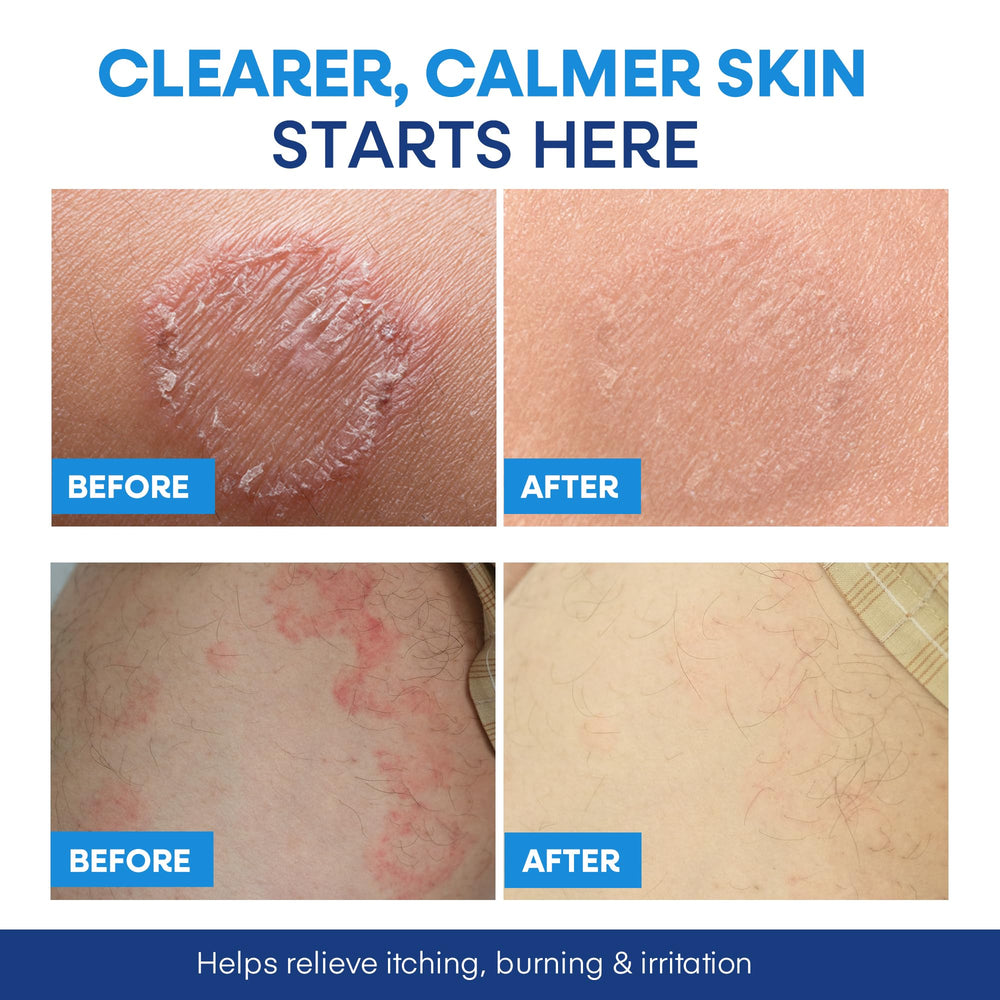 Hermon Antifungal Body Wash lathering on feet to remove sweat and odor.
