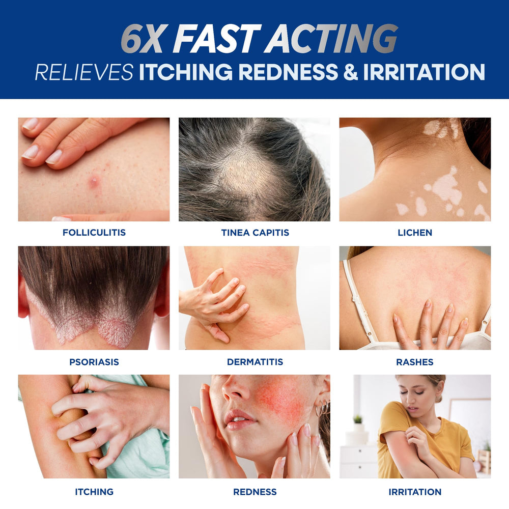 Hermon Folliculitis Cream being applied to skin for scalp, face, and body care.