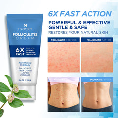 Hermon Folliculitis Cream label close-up highlighting a clean, soothing formula for skin.