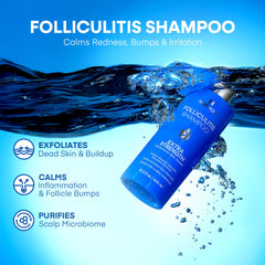 Hermon Folliculitis Shampoo hand massage demonstrating gentle scalp cleansing.