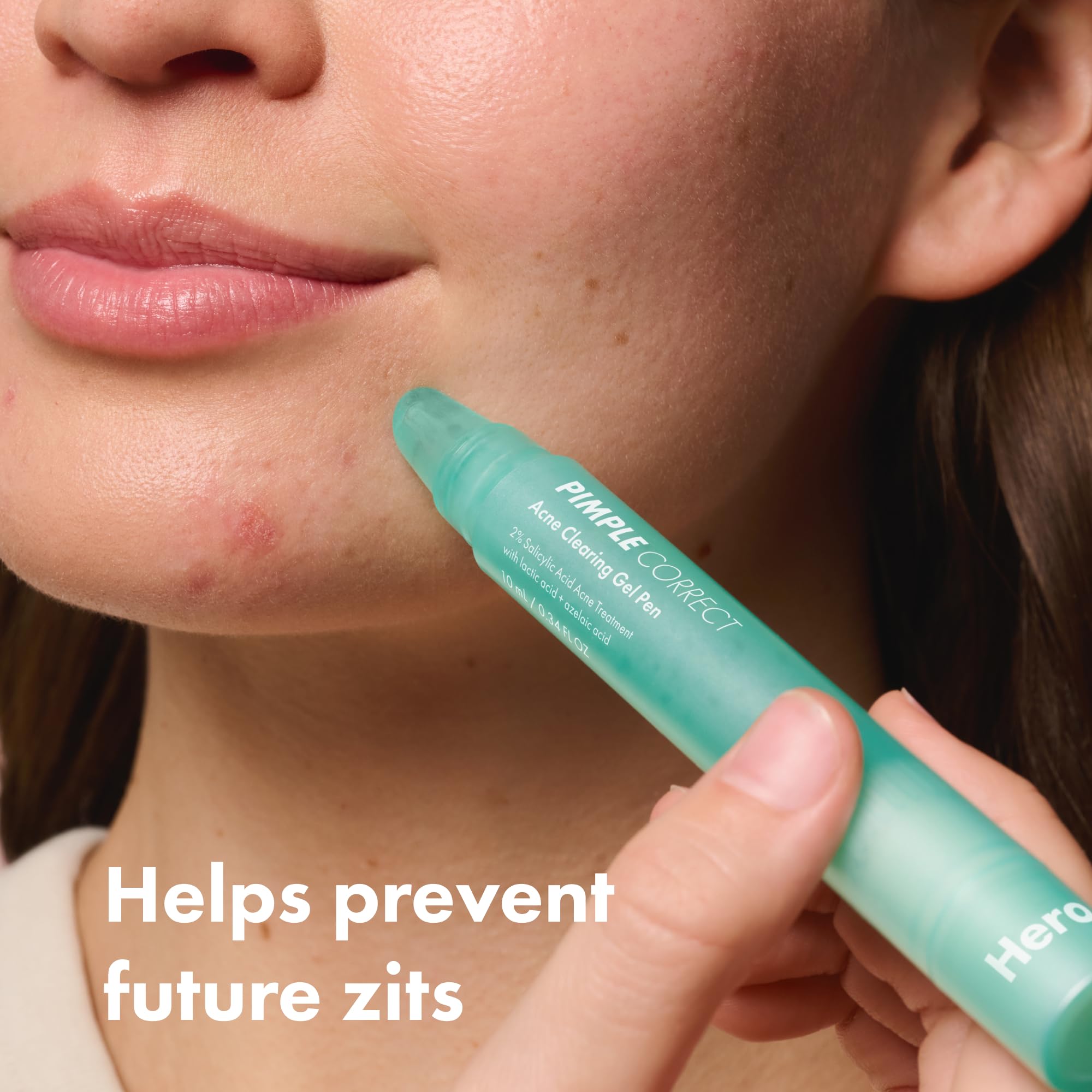 Hero Cosmetics Pimple Correct pen close-up shows gel drying on skin