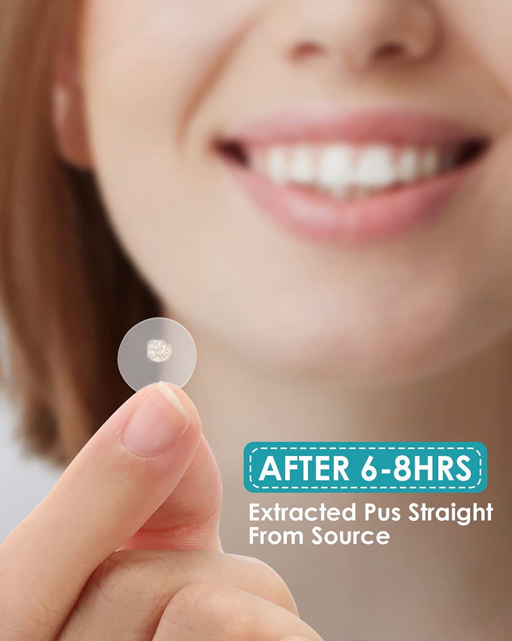 HeroLabs Acne Patch applied on skin showing discreet coverage and soothing relief.