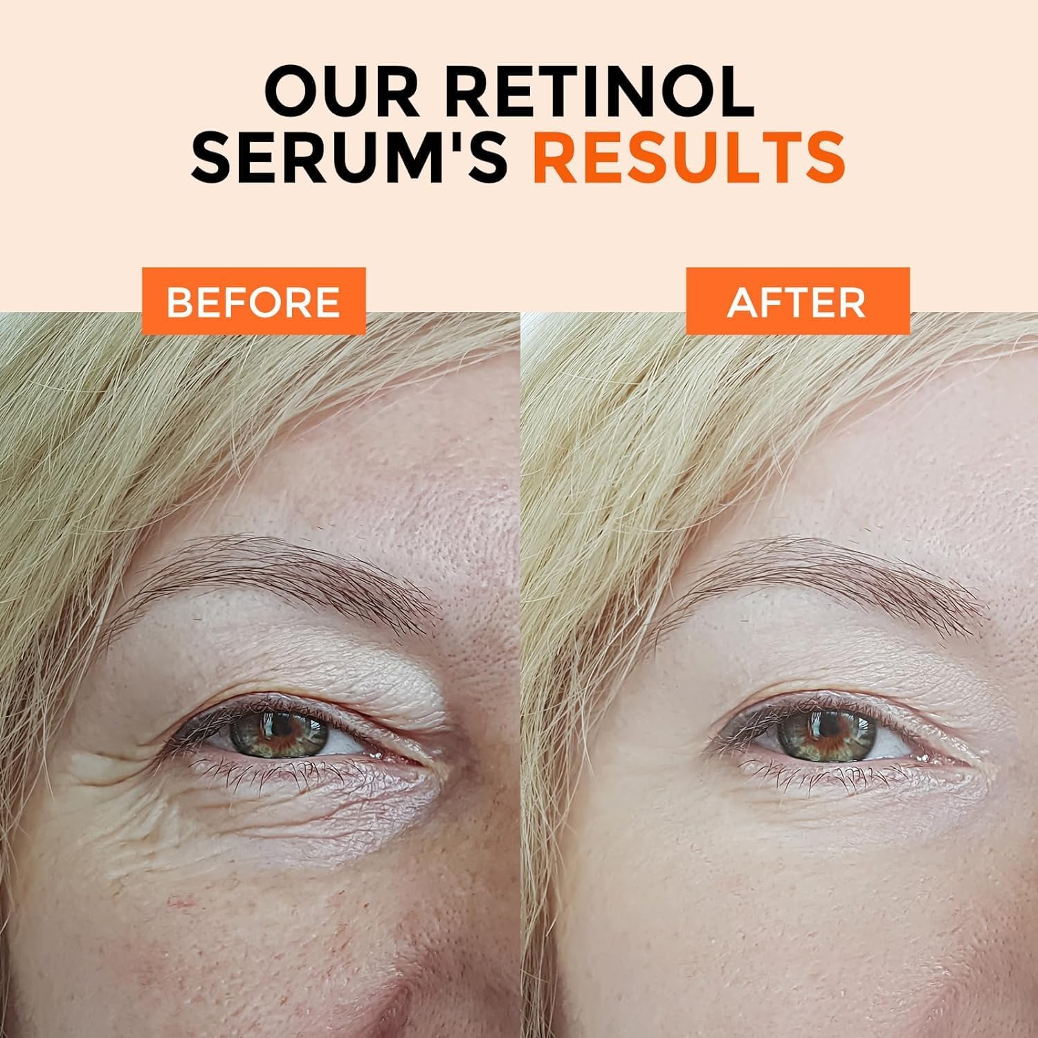 Ingredientes clave hidratantes hamamelis jojoba aloe en Herolabs Retinol Serum