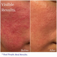 Hey Honey Relax bottle dispense demonstrates clean application for soothing redness.