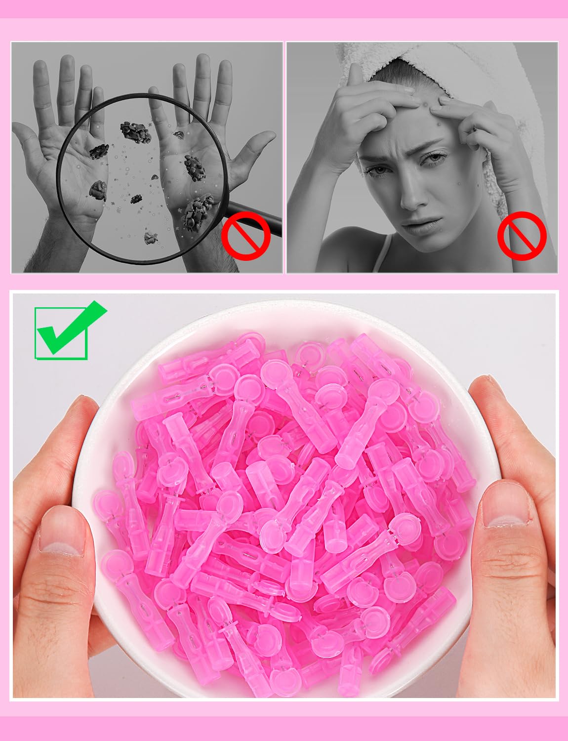HFWTWPY versatile blemish removal tools for whiteheads and blackheads.