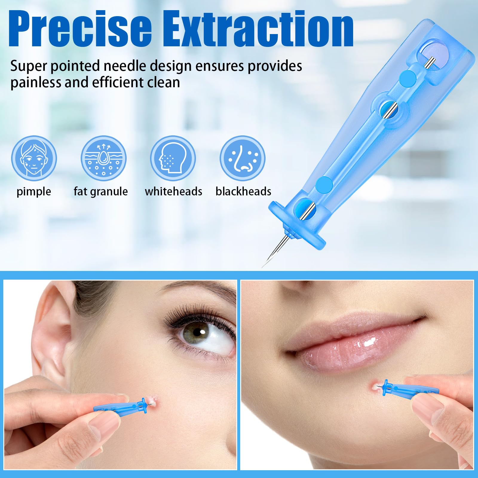 HFYHWT pimple popping tools at home enable convenient use with professional-grade results
