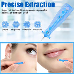 HFYHWT pimple popping tools at home enable convenient use with professional-grade results