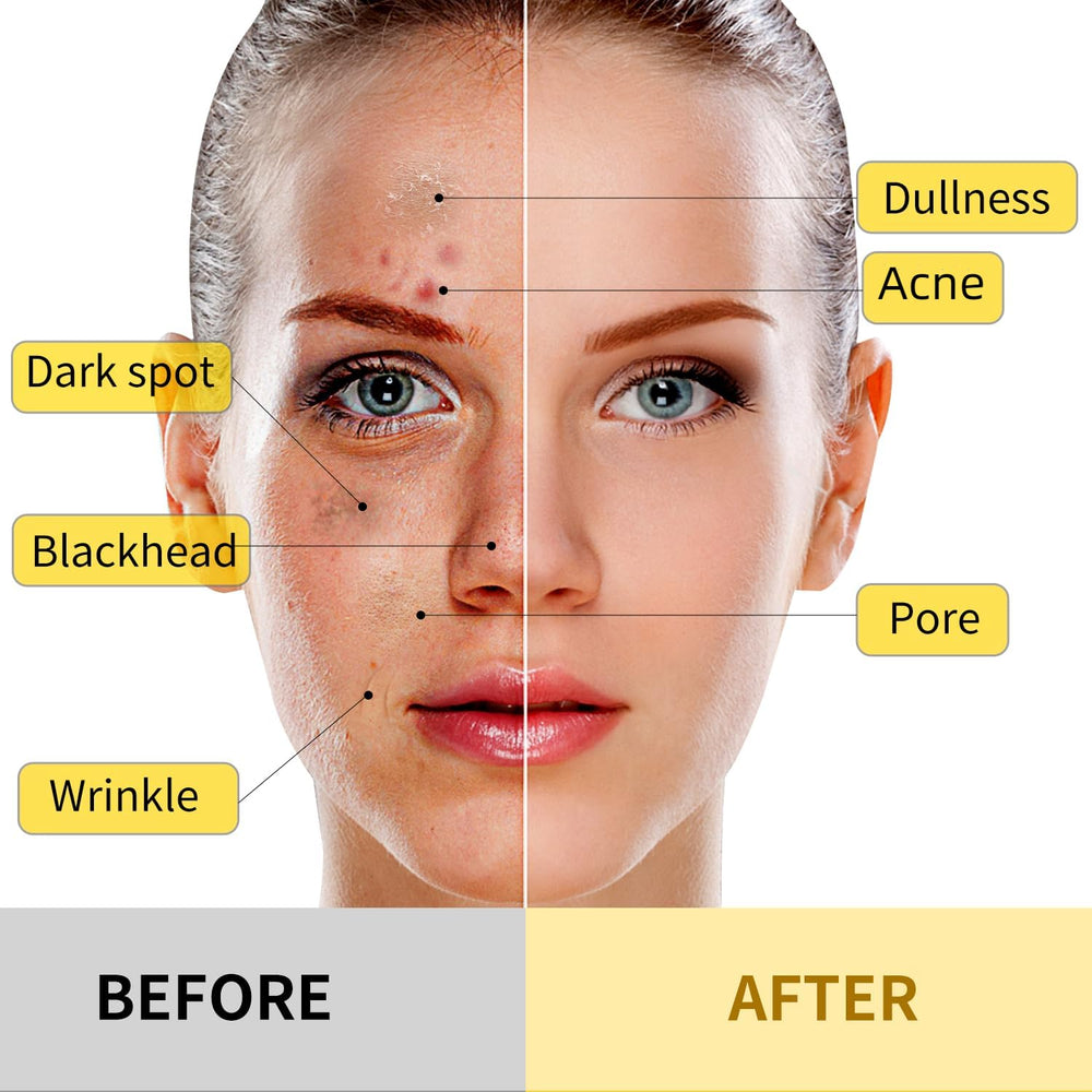 Hicream Turmeric Vitamin C Clay Mask kaolin ingredients highlight natural cleansing