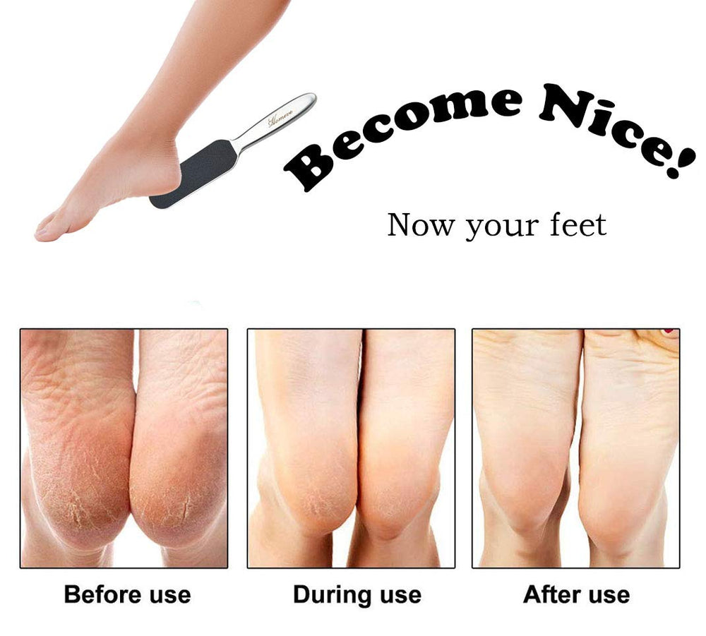 Homeve use in bathroom setup showing convenient at-home foot care routine