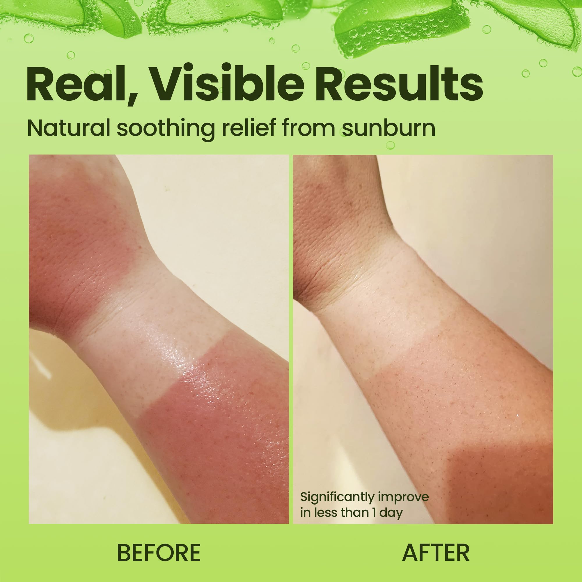 Honeyskin gel de aloe vera, refresco rápido tras la exposición al sol.