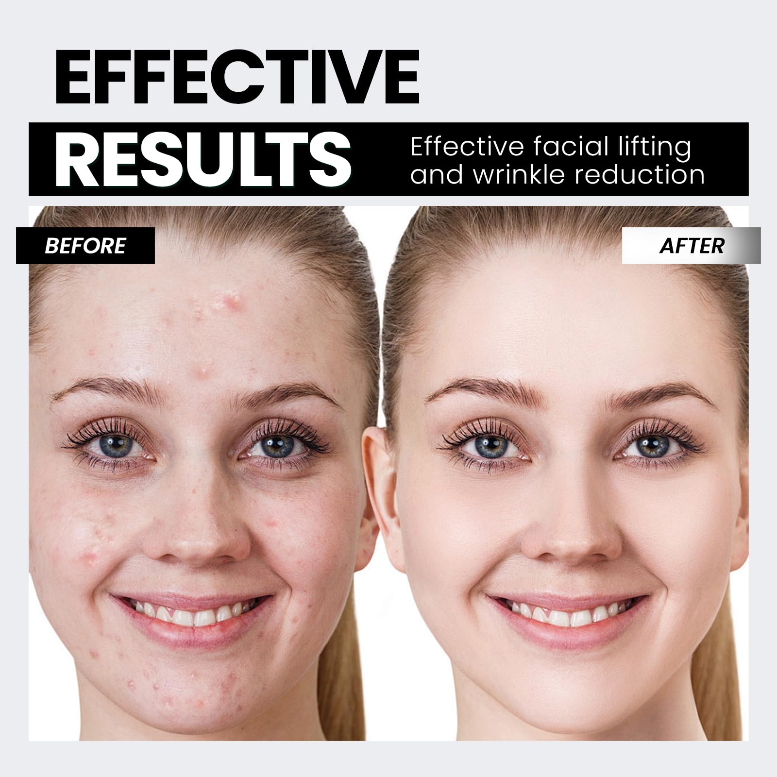 Hunvva EP-300 used on neck contour to support lifted jawline.