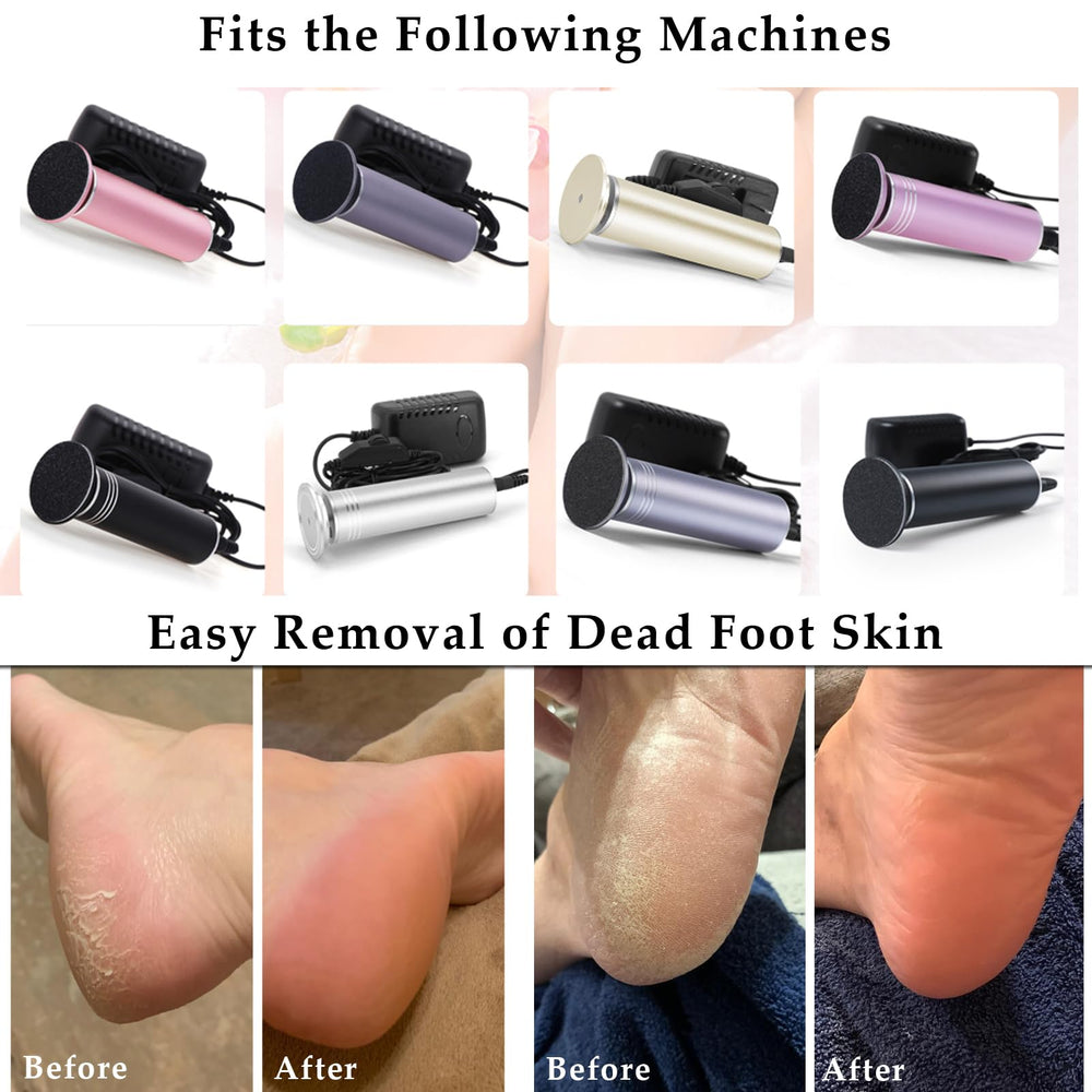 IBNG discs in use with an electric callus remover.