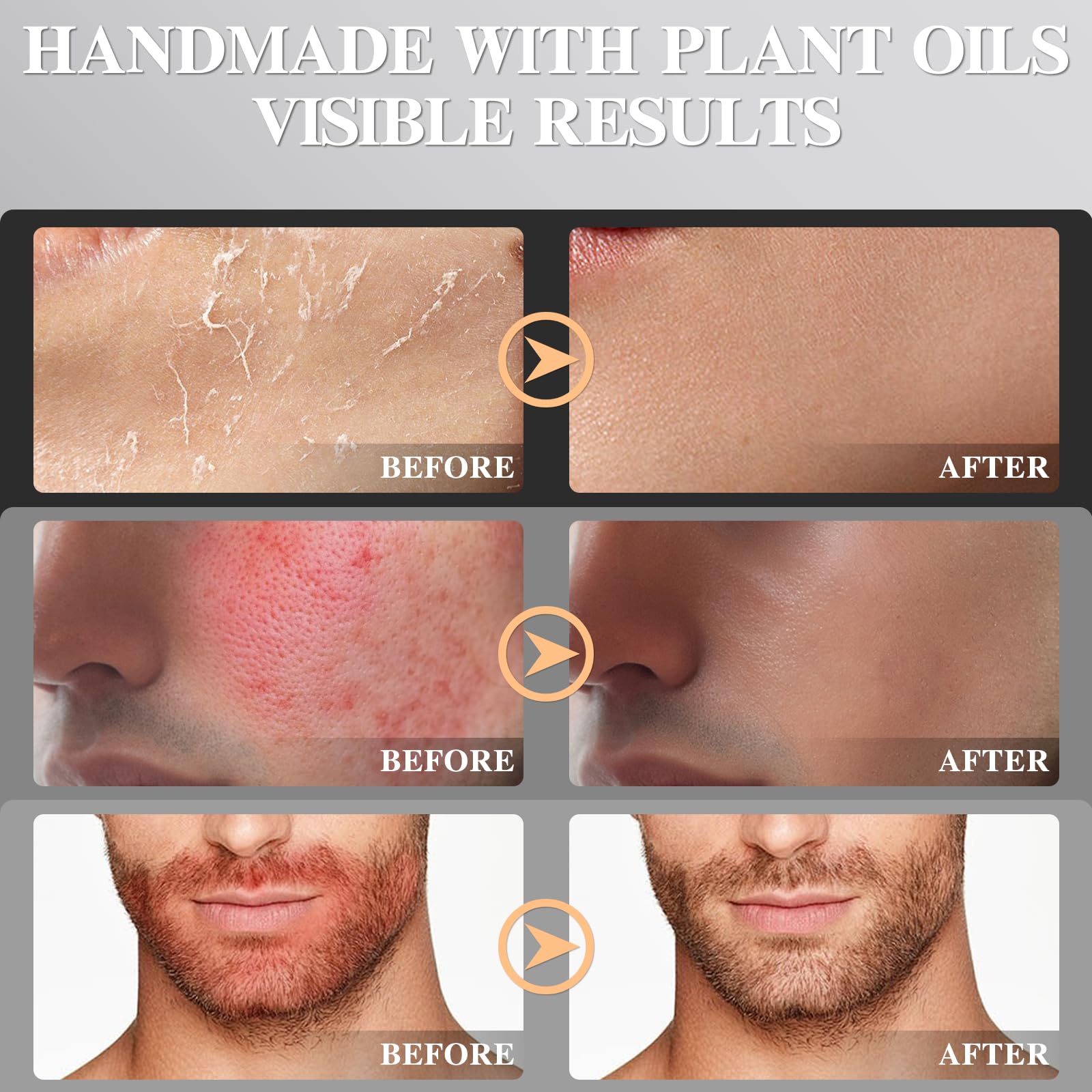 ICIKOL miel de Manuka como ingrediente clave para nutrición natural.