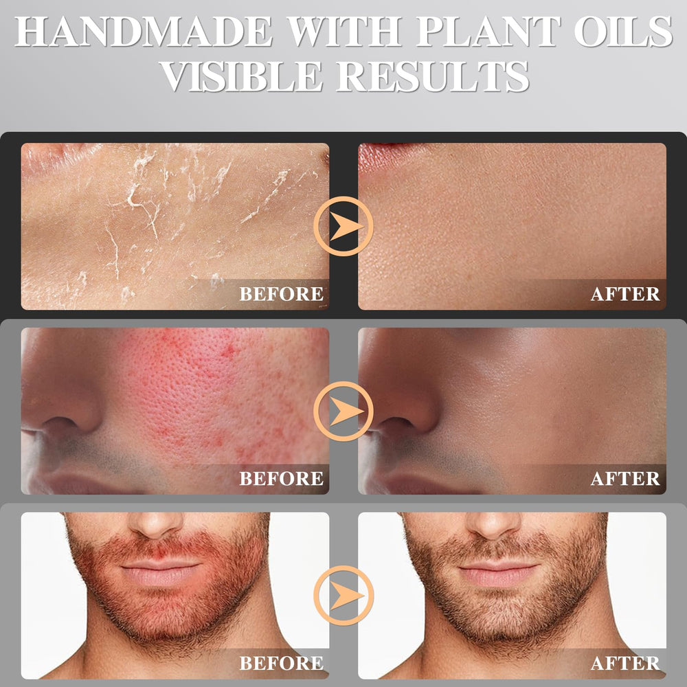 ICIKOL miel de Manuka como ingrediente clave para nutrición natural.