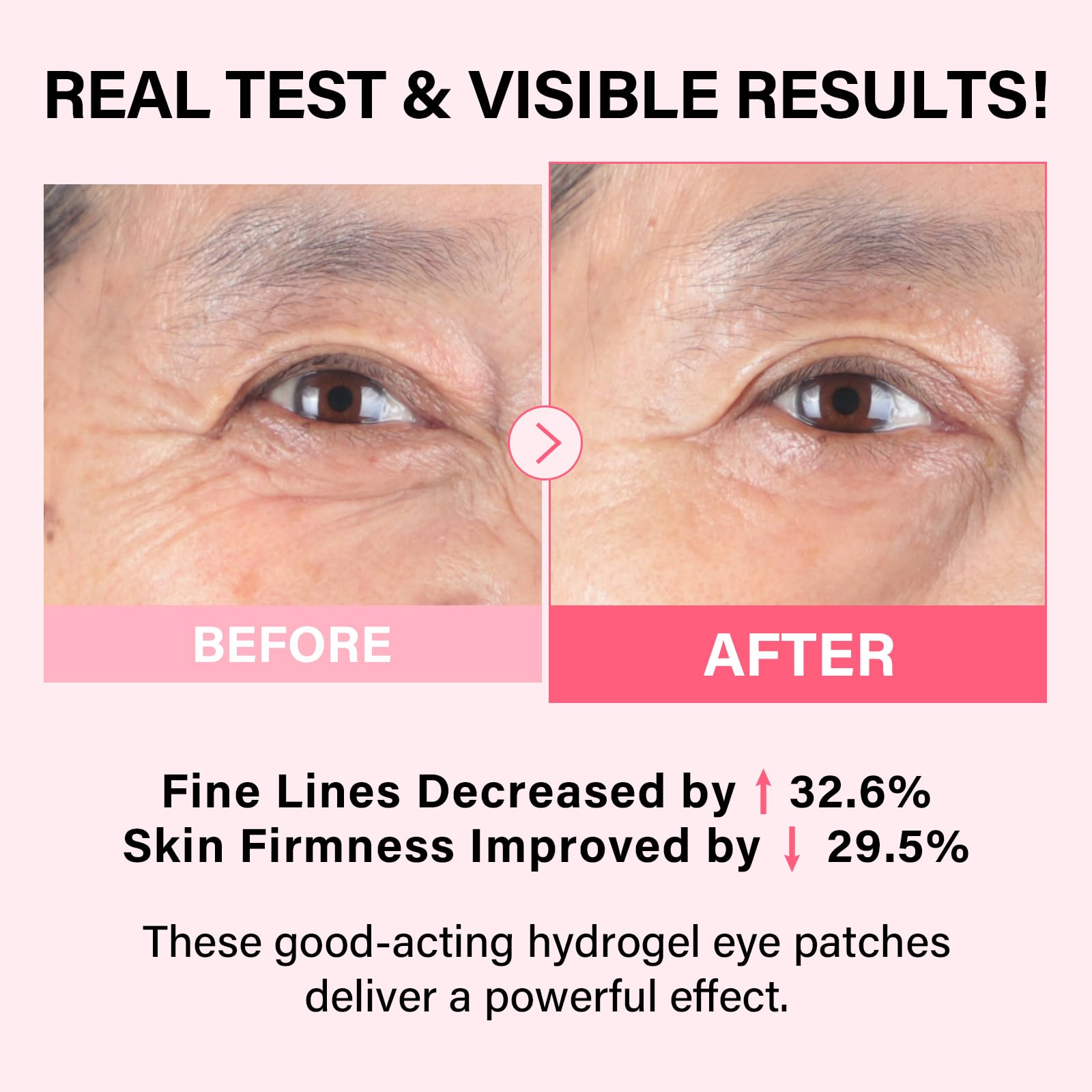iMethod PDRN Eye Patches individual patch close-up, soothing gel texture.
