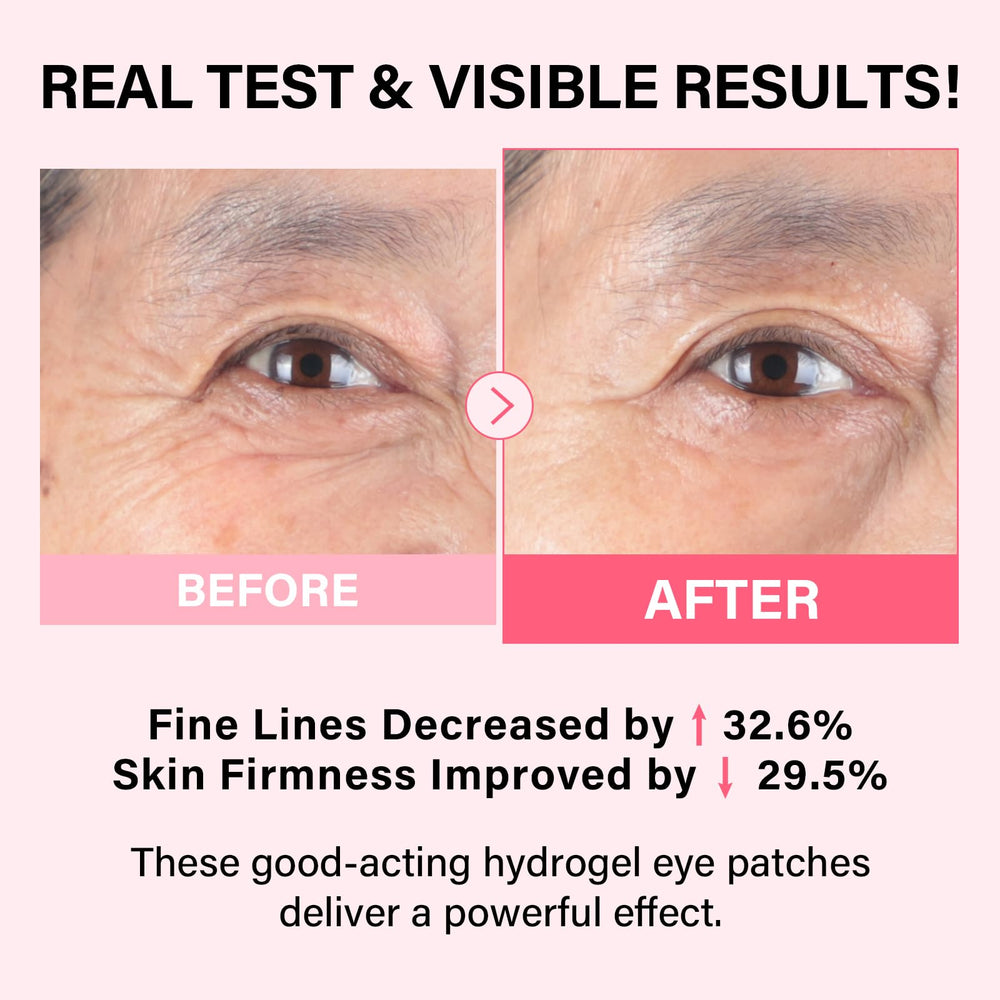 iMethod PDRN Eye Patches individual patch close-up, soothing gel texture.
