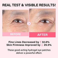 iMethod PDRN Eye Patches individual patch close-up, soothing gel texture.