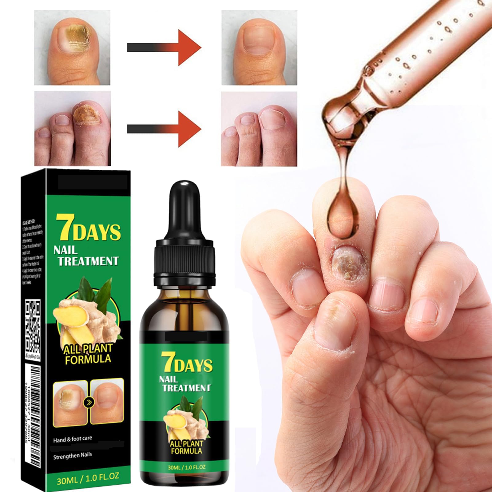IMOLL cuticle care oil applicator ready to nourish nail edges.