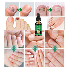 IMOLL ginger nail growth serum dropper applying to nails.