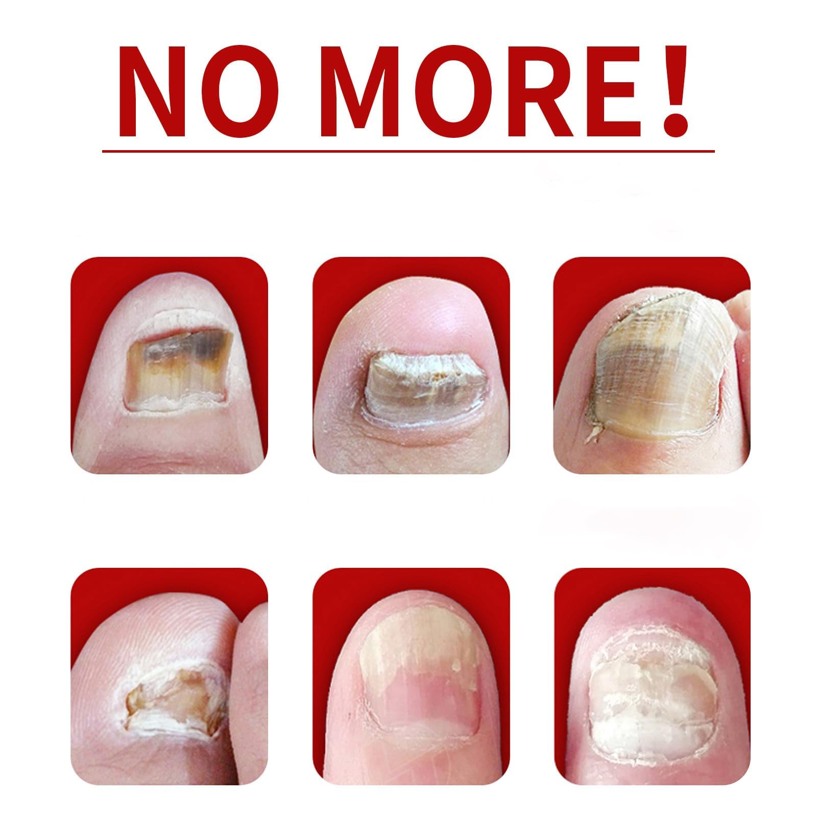 IMOLL Ginger Nail Treatment two-pack packaging for convenient use.