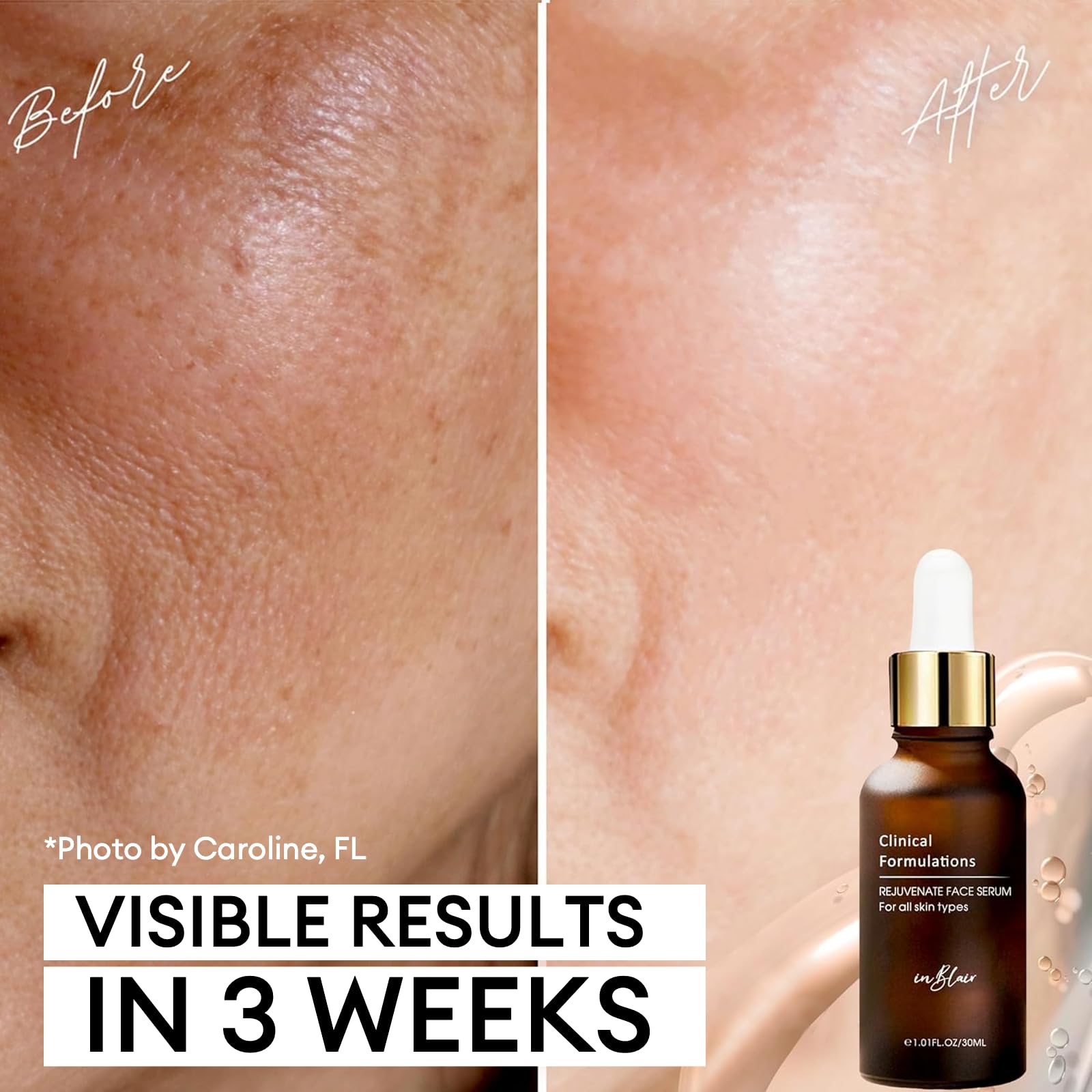 Inblair Rejuvenate Serum hyaluronic acid molecules visualize moisture retention