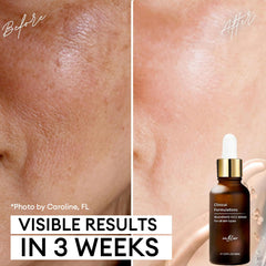 Inblair Rejuvenate Serum hyaluronic acid molecules visualize moisture retention