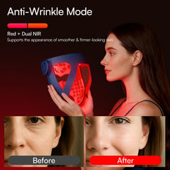 INIA Glow 4D mask with dual NIR lights for multi-layer skin care potential.