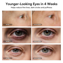 INIA red light eye mask smoothing wrinkles around the eye area.