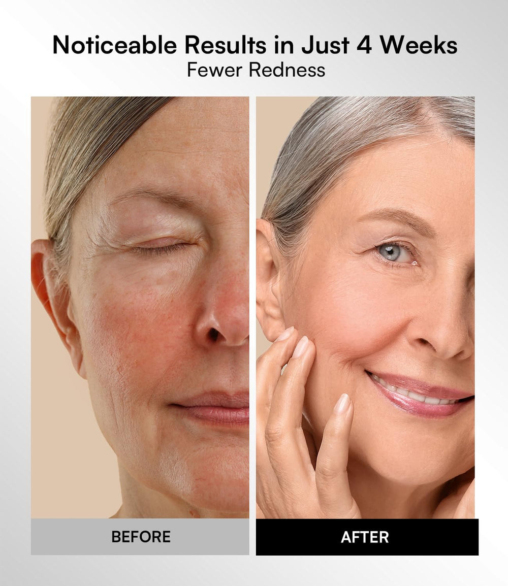 Timer dial on INIA mask lets you select 10, 20, or 30 minutes.