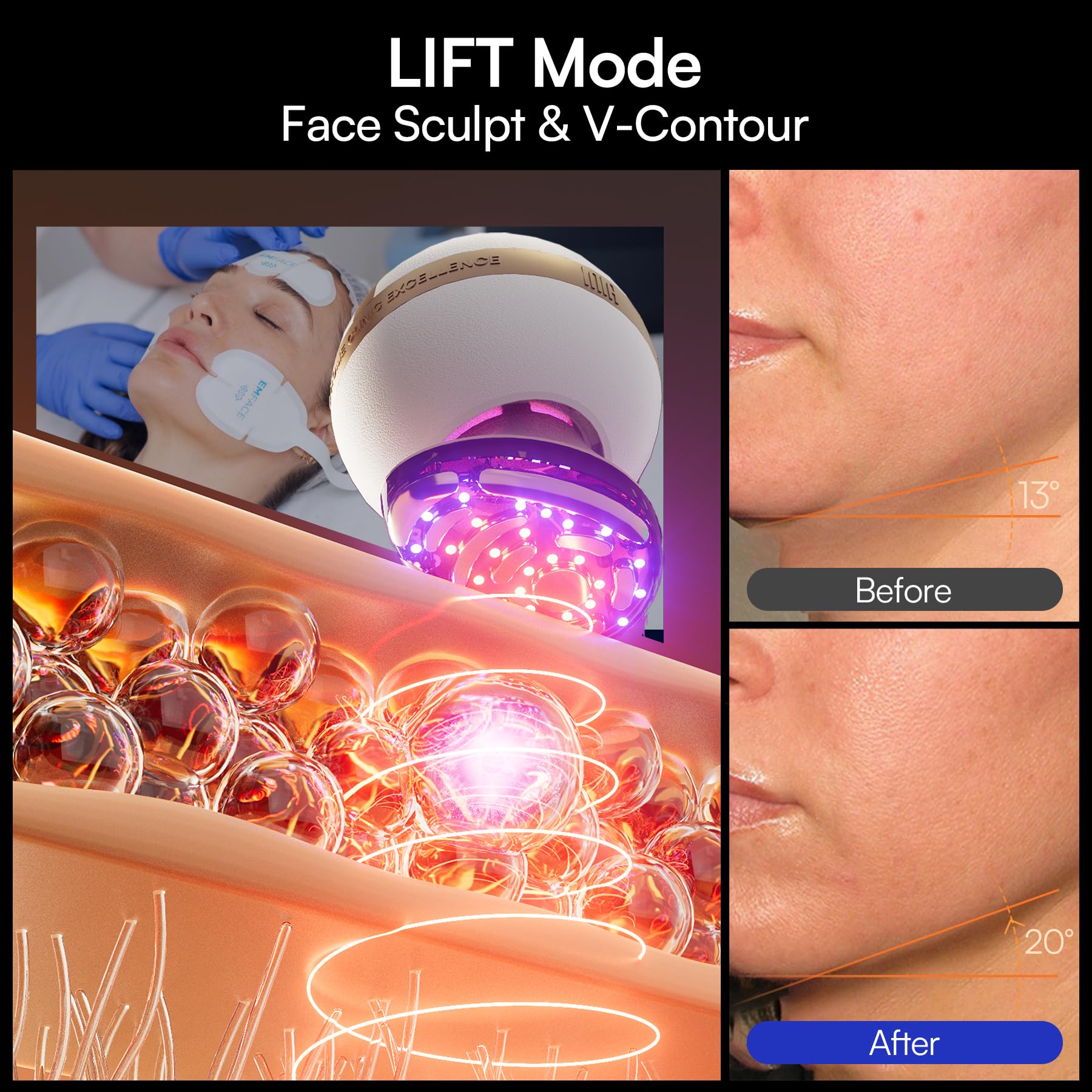 INIA SPHERA cryo cooling delivers refreshing cooling therapy
