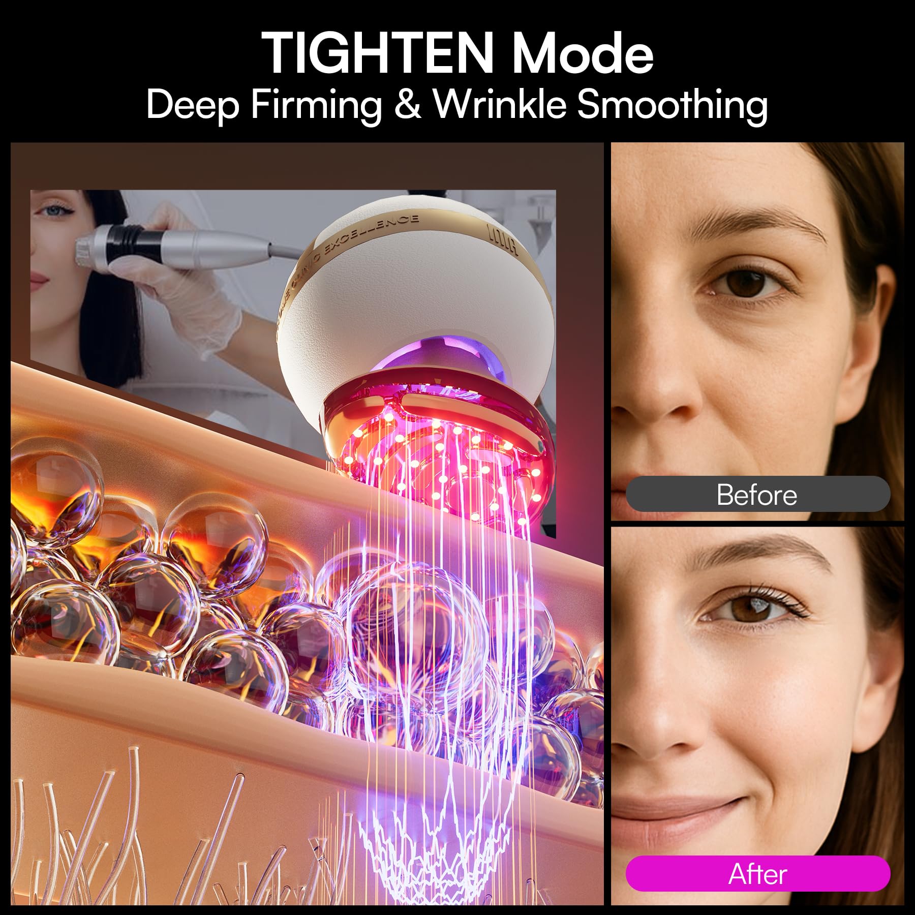 INIA SPHERA microcurrent defines facial contours with gentle stimulation