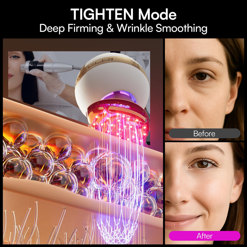 INIA SPHERA microcurrent defines facial contours with gentle stimulation